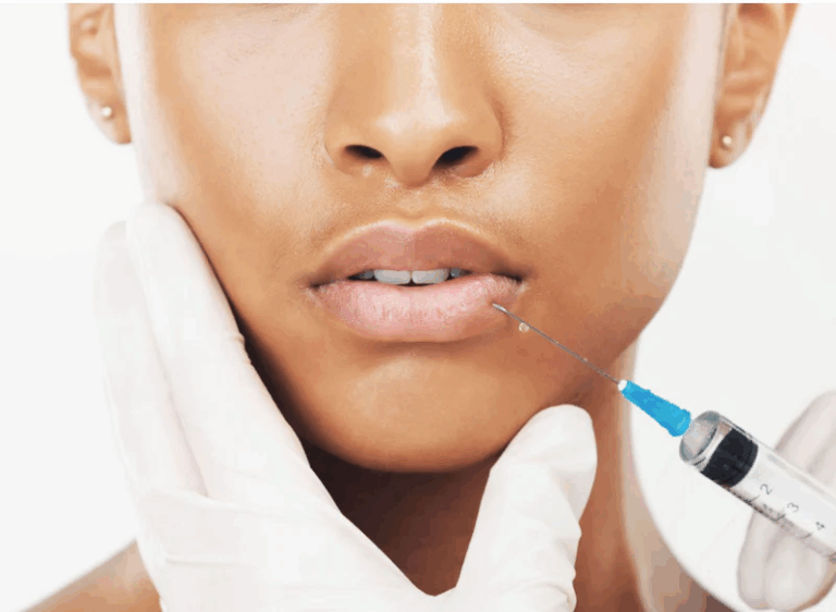 Lip Fillers at The Medispa: Enhance, Define, and Embrace Your Natural Smile Lip Fillers at The Medispa: Enhance, Define, and Embrace Your Natural Smile
