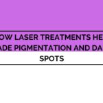 Laser Treatments Effectively Fade Pigmentation and Dark Spot