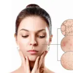 Best Dermatologist in Kolkata for Child Adult & Senior Skin Care