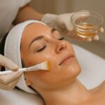 Chemical Peels in Dubai: Erasing Acne Scars for Good