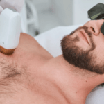 How Many Sessions Do You Need for Toronto Laser Hair Removal?