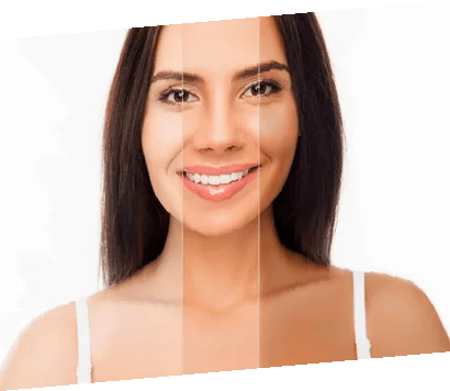 Skin Whitening in Dubai: The Definitive Patient Manual