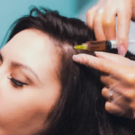 PRP Hair Treatment in Dubai: Revitalize Your Scalp Health