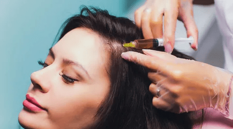 PRP Hair Treatment in Dubai: Revitalize Your Scalp Health
