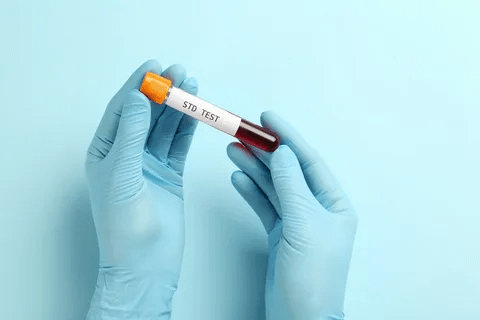 STD Test in Dubai: Advanced Pathogen PCR Lab Testing STD Test in Dubai