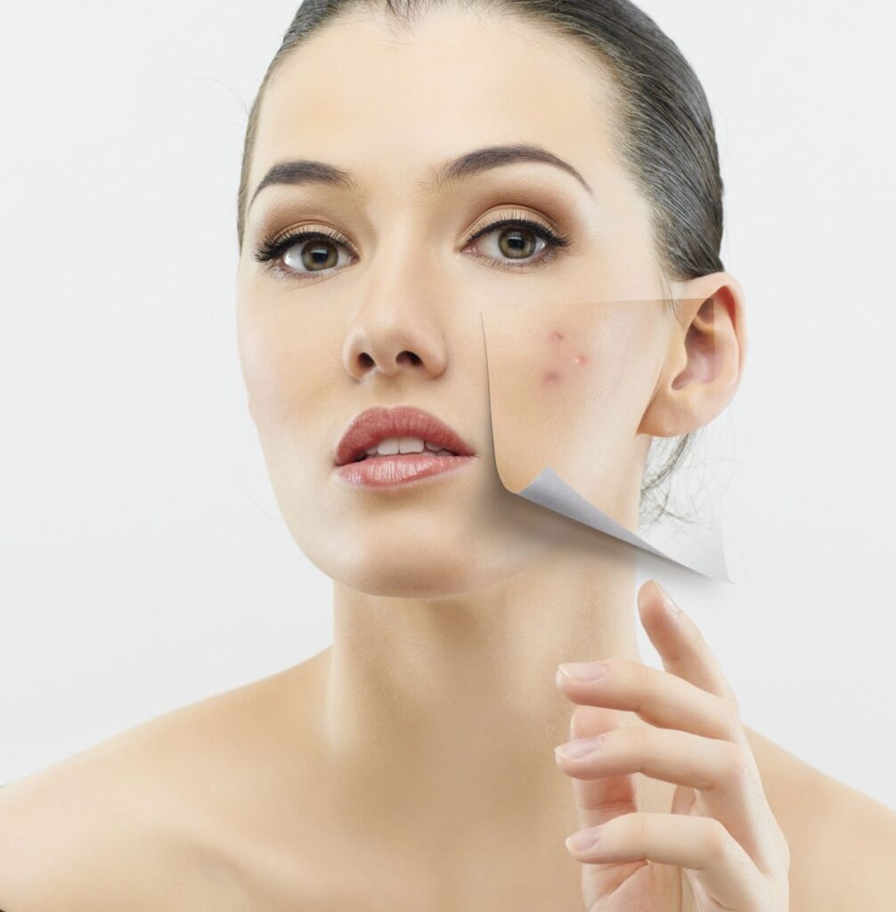 Scar Removal in Dubai: Medical Excellence in Skin Revision