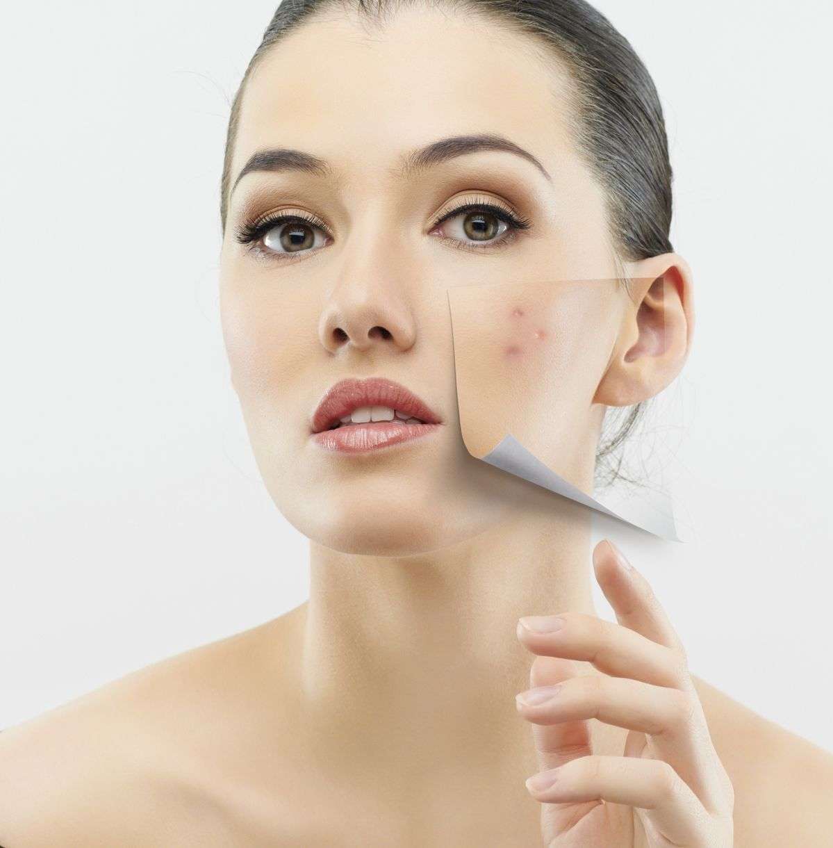 Scar Removal in Dubai: Medical Excellence in Skin Revision