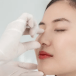 Rhinoplasty in Dubai: A Comprehensive Patient Guide