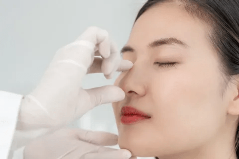 Rhinoplasty in Dubai: A Comprehensive Patient Guide Rhinoplasty in Dubai: A Comprehensive Patient Guide