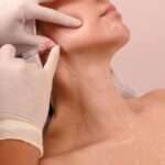 Belkyra Treatment in Dubai: Non-Surgical Chin Contouring