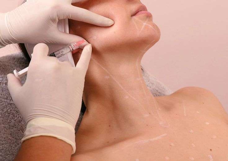 Belkyra Treatment in Dubai: Non-Surgical Chin Contouring