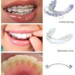 How to Choose the Right Dentist in Redlands for Your Family How to Choose the Right Dentist in Redlands for Your Family