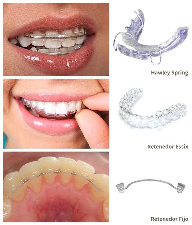 How to Choose the Right Dentist in Redlands for Your Family How to Choose the Right Dentist in Redlands for Your Family