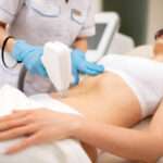 Is Coolsculpting Fat Freezing Right for Your Goals?