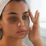 Dark Circles Treatment in Islamabad: Safe Options for Every Skin Type