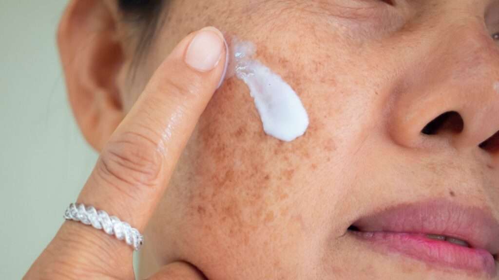 Dark Spot Treatment Options for Healthier and More Even-Looking Skin Dark Spot Treatment Options for Healthier and More Even-Looking Skin