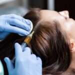 Who Is the Ideal Candidate for Exosomes Hair Therapy In Islamabad?