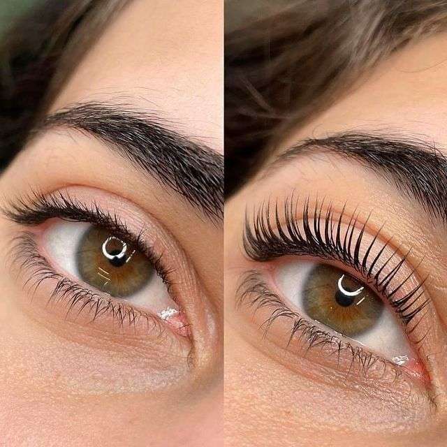Why Choose Eyelash Hair Transplant in Dubai for Volume Why Choose Eyelash Hair Transplant in Dubai for Volume