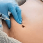 Fat Melting Injection in Dubai 2026