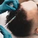 Hair Fillers treatment in Dubai: Non-Surgical Hair Success