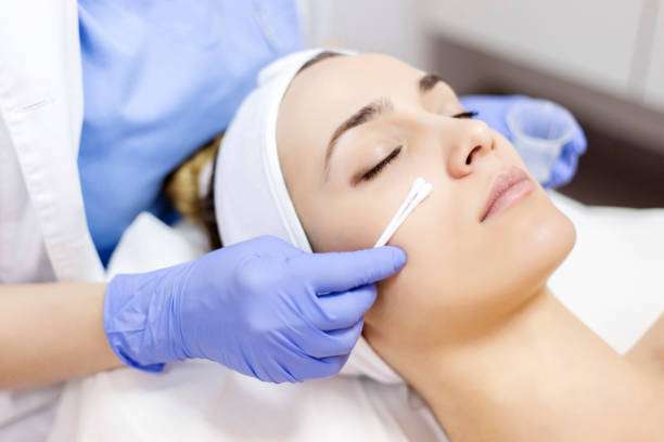 How Does Chemical Peels Improve Skin Texture?