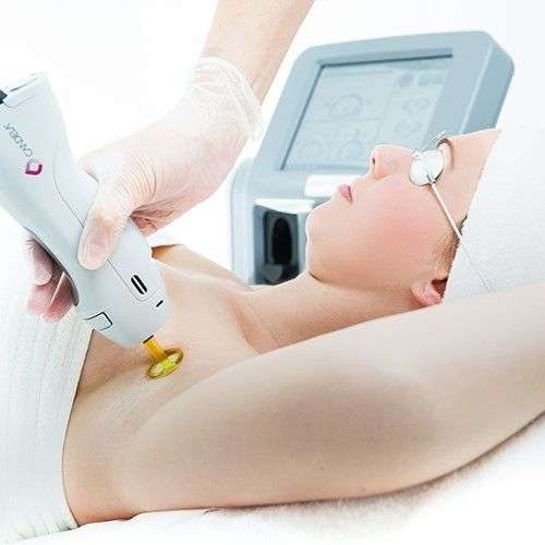 Laser Hair Removal in Dubai: Safe, Effective, Permanent