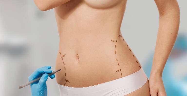Liposuction in Islamabad: Why More Pakistanis Are Choosing This Procedure Liposuction in Islamabad: Why More Pakistanis Are Choosing This Procedure