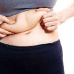 Liposuction Techniques and Innovations for Better Results