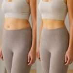 Is a Mommy Makeover Dubai Right for Your Body?