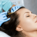Expert PRP Hair Treatment in Dubai for Male & Female