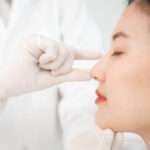 Rhinoplasty Procedure with Natural Facial Results
