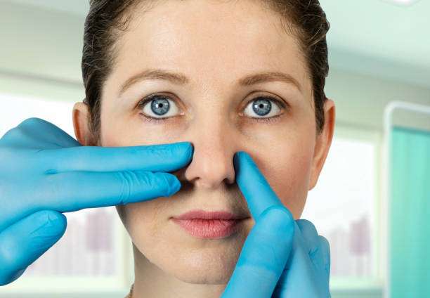 Key Factors to Consider When Planning a Rhinoplasty in Riyadh