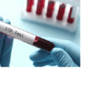Advanced STD Test in Dubai: Trusted Health Screening