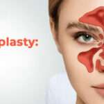 Can Septoplasty in Islamabad Improve Daily Comfort?