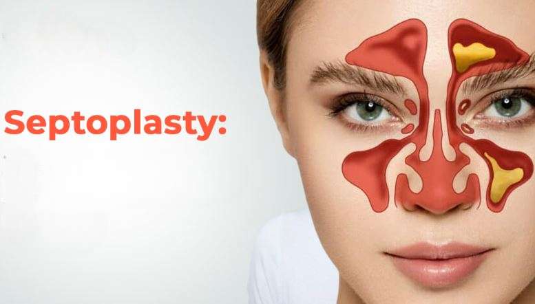 Can Septoplasty in Islamabad Improve Daily Comfort?