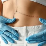 Tummy Tuck Surgery in Dubai: Enhancing Body Proportion