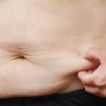 Benefits of Choosing a Tummy Tuck for Body Contouring in Riyadh