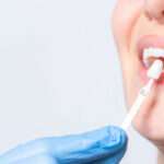 Veneers in Islamabad: The Secret to a Confident and Camera-Ready Look