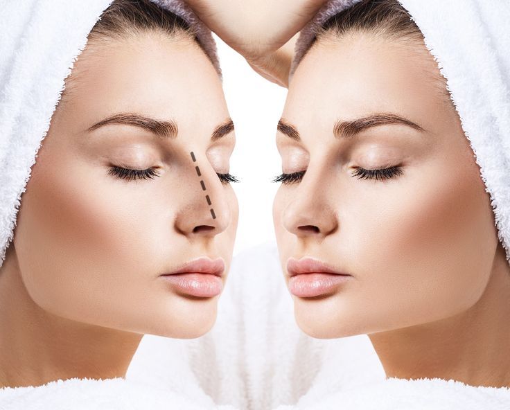 Rhinoplasty in Dubai: Trusted Surgical Improvement Rhinoplasty in Dubai: Trusted Surgical Improvement