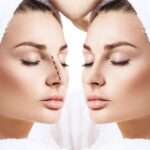 Rhinoplasty in Dubai: Trusted Surgical Improvement Rhinoplasty in Dubai: Trusted Surgical Improvement