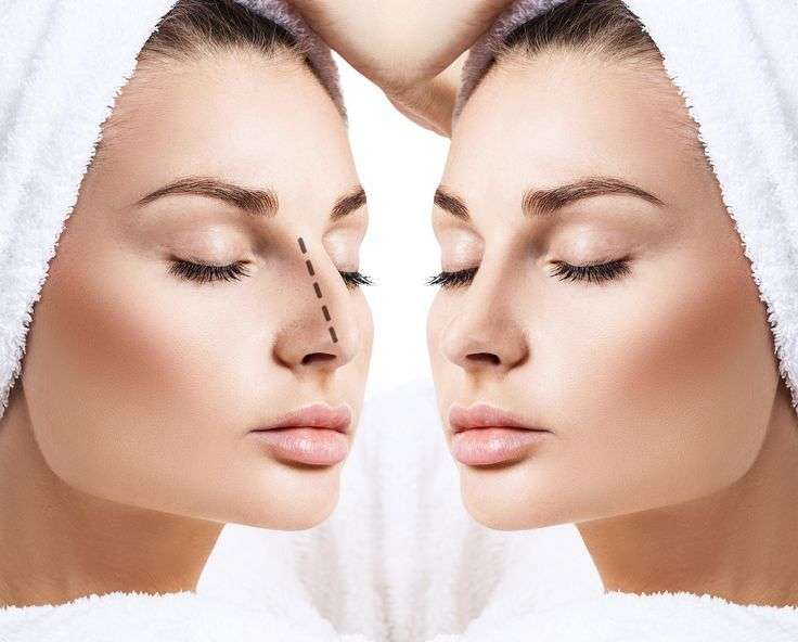 Rhinoplasty in Dubai: Trusted Surgical Improvement