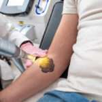 Tattoo Removal in Islamabad: What to Expect from Your Treatment Journey Tattoo Removal in Islamabad: What to Expect from Your Treatment Journey
