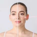Laser Acne Scar Treatment in Riyadh for Smoother Complexion Improvement