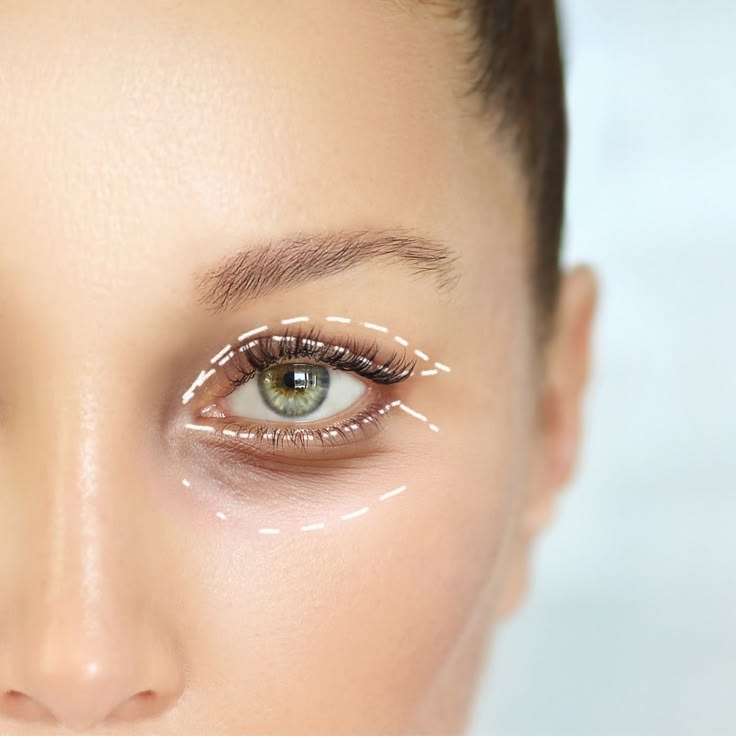 Refresh Your Gaze with Blepharoplasty Dubai Refresh Your Gaze with Blepharoplasty Dubai