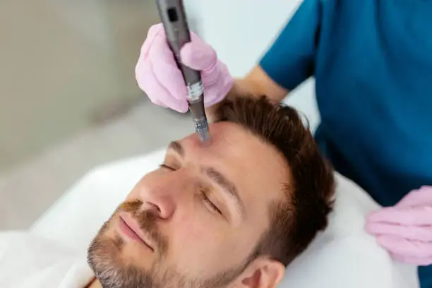 Does Microneedling Treatment Suit Every Skin Type? Does Microneedling Treatment Suit Every Skin Type?