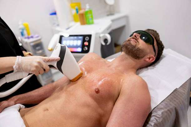 Top Tips for Preparing for Electrolysis Hair Removal Sessions