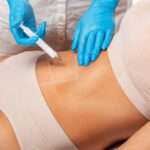 Fat Melting Injections for Refining Areas Resistant to Diet and Exercise