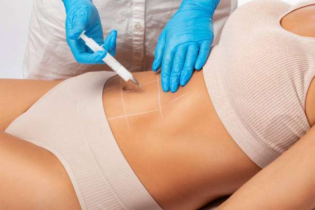 Fat Melting Injections for Refining Areas Resistant to Diet and Exercise Fat Melting Injections for Refining Areas Resistant to Diet and Exercise