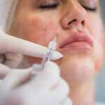 How Fast Does Skin Booster Injection Work?