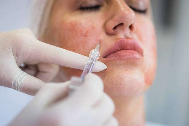 How Fast Does Skin Booster Injection Work?
